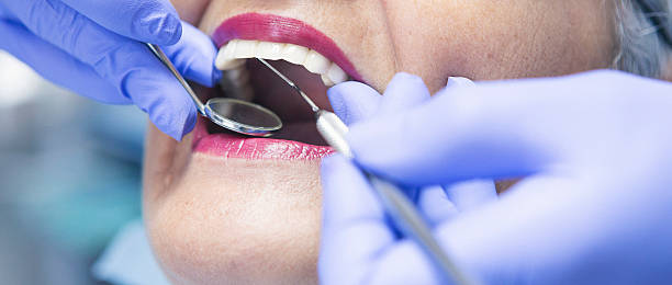 Best Chipped Tooth Repair Near Me  in Crandon, WI